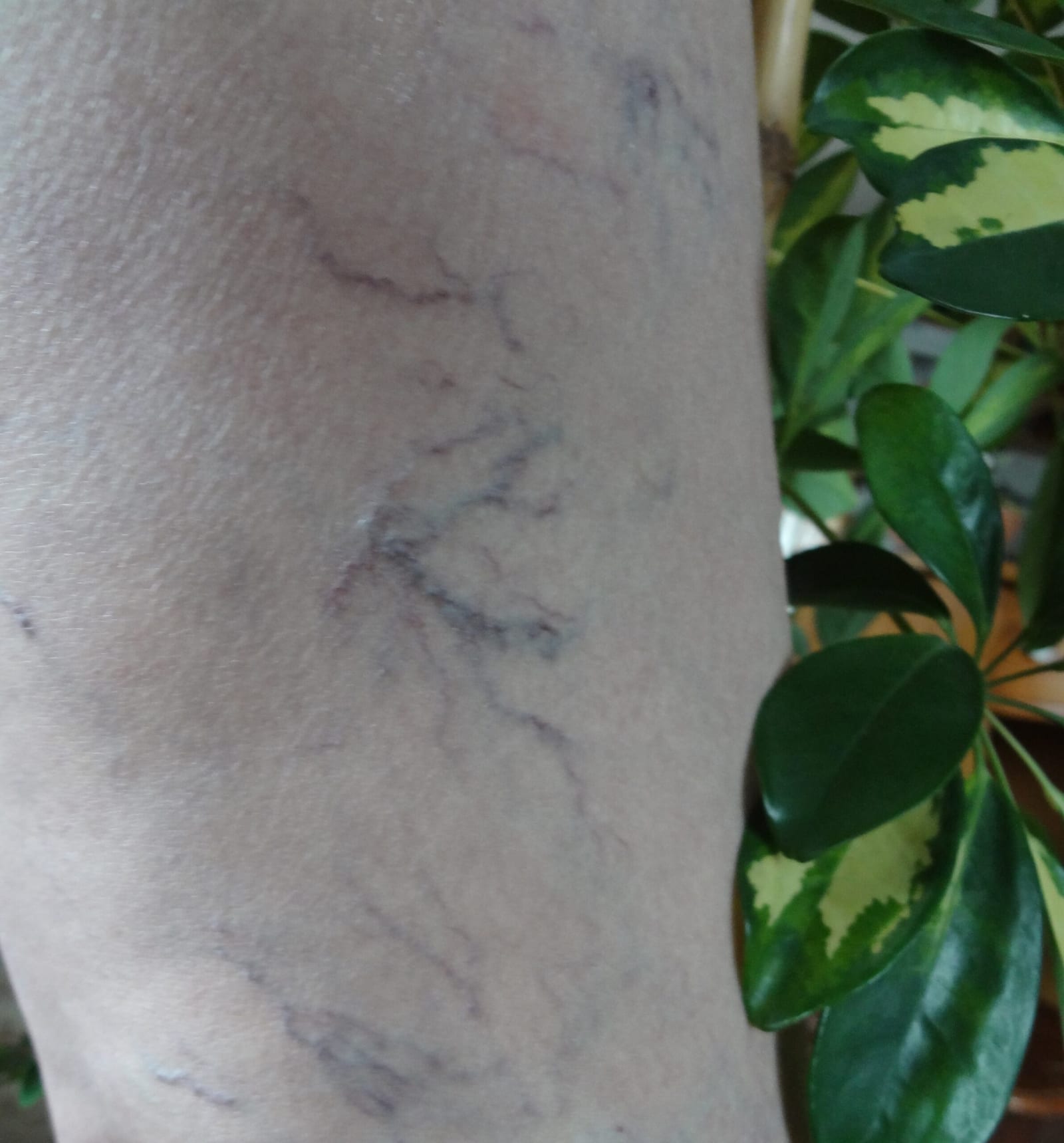 vein